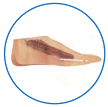 Plastic embedded element in the forefoot.